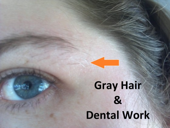 Gray Hair Dental Work