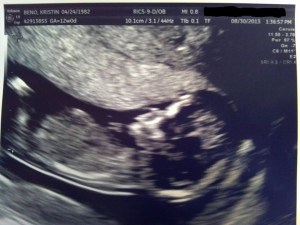 August 2013 12 weeks blacked out